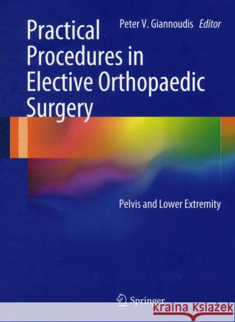 Practical Procedures in Elective Orthopaedic Surgery: Pelvis and Lower Extremity Giannoudis, Peter V. 9780857298133 Springer, Berlin