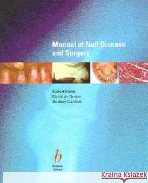 Manual of Nail Disease and Surgery Robert Baran R. Baran 9780865426382 Blackwell Publishers