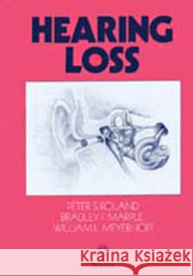 Hearing Loss Peter S. Roland Peter Roland Bradley Marple 9780865776234 Thieme Medical Publishers
