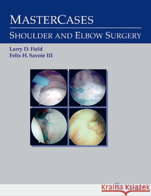 Master Cases, Shoulder and Elbow Surgery Savoie                                   Larry D. Field Felix H. Savoie 9780865778733 Thieme Medical Publishers