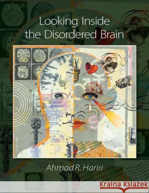 Looking Inside the Disordered Brain Hariri, Ahmad R. 9780878939794