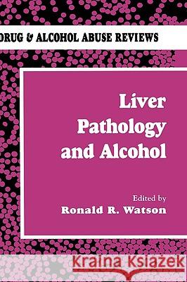 Liver Pathology and Alcohol: Drug & Alcohol Abuse Reviews Watson, Roland R. 9780896032064 Humana Press