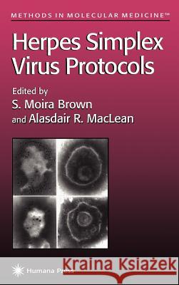 Herpes Simplex Virus Protocols S. Moira Brown Moira S. Brown Alasdair MacLean 9780896033474 Humana Press