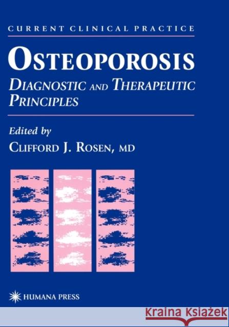 Osteoporosis: Diagnostic and Therapeutic Principles Rosen, Clifford J. 9780896033740