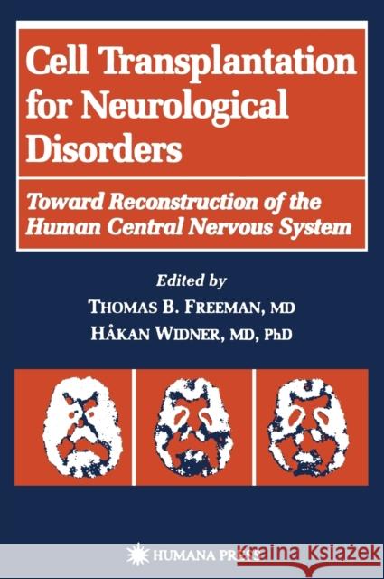 Cell Transplantation for Neurological Disorders Freeman, Thomas B. 9780896034495 Humana Press