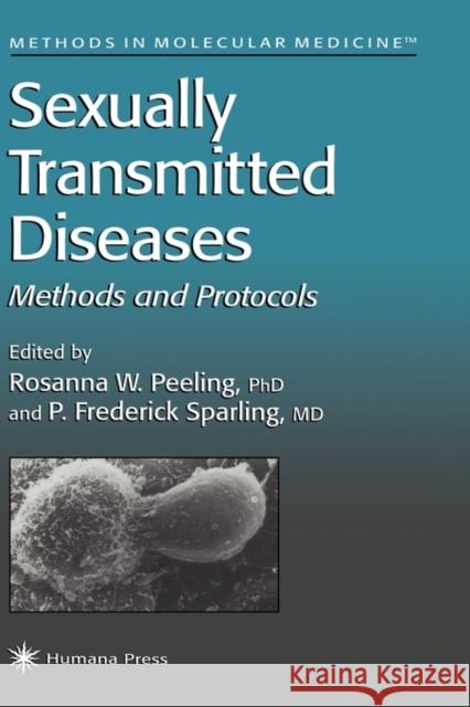 Sexually Transmitted Diseases Rosanna Peeling P. Frederick Sparling 9780896035355 Humana Press