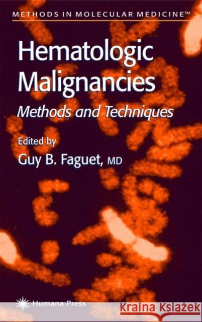 Hematologic Malignancies: Methods and Techniques Faguet, Guy B. 9780896035430 Humana Press