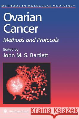Ovarian Cancer: Methods and Protocols Bartlett, John M. S. 9780896035836 Humana Press
