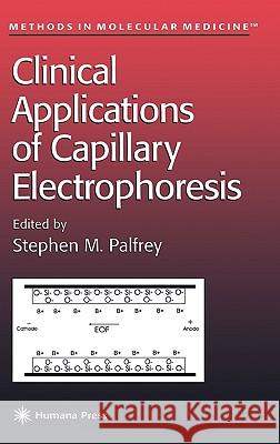 Clinical Applications of Capillary Electrophoresis Stephen M. Palfrey 9780896036390 Humana Press