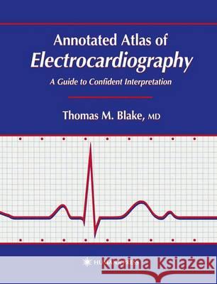 Annotated Atlas of Electrocardiography: A Guide to Confident Interpretation Blake, Thomas M. 9780896037625