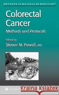 Colorectal Cancer: Methods and Protocols Powell, Steven M. 9780896037670 Humana Press
