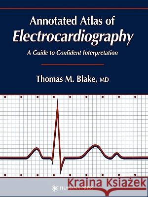 Annotated Atlas of Electrocardiography: A Guide to Confident Interpretation Blake, Thomas M. 9780896037687