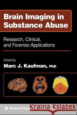 Brain Imaging in Substance Abuse: Research, Clinical, and Forensic Applications Kaufman, Marc J. 9780896037700 Humana Press