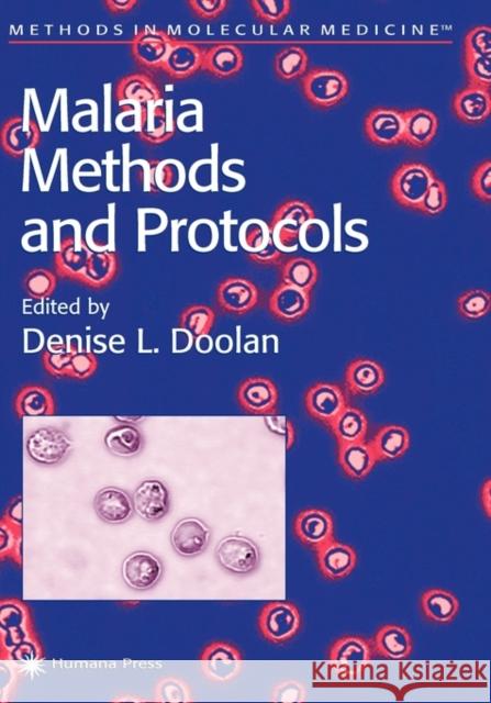 Malaria Methods and Protocols Denise L. Doolan 9780896038233 Humana Press