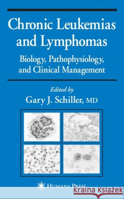 Chronic Leukemias and Lymphomas: Biology, Pathophysiology, and Clinical Management Schiller, Gary J. 9780896039070 Humana Press