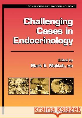 Challenging Cases in Endocrinology Mark E. Molitch 9780896039148 Humana Press