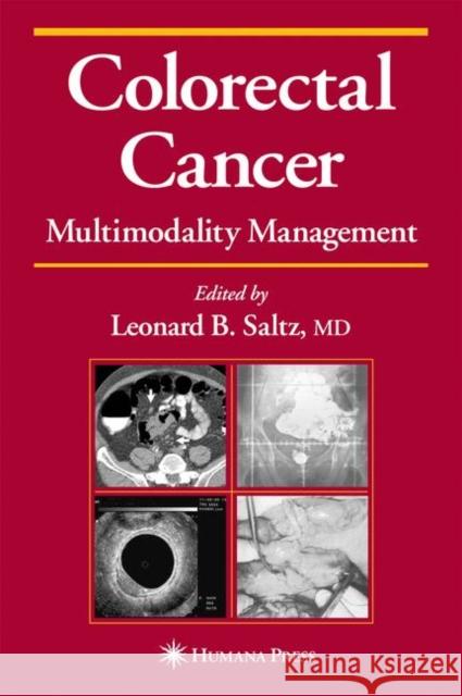 Colorectal Cancer: Multimodality Management Saltz, Leonard B. 9780896039353 Humana Press