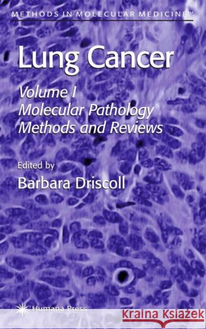 Lung Cancer: Volume 1: Molecular Pathology Methods and Reviews Driscoll, Barbara 9780896039858 Humana Press