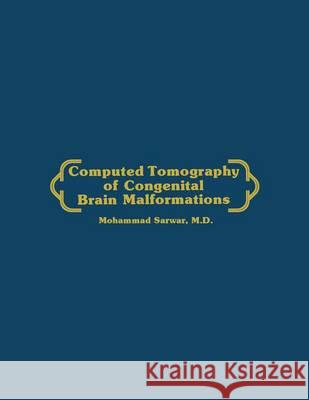 Computed Tomography of Congenital Brain Malformations Mohammed Sarwar 9780898386950