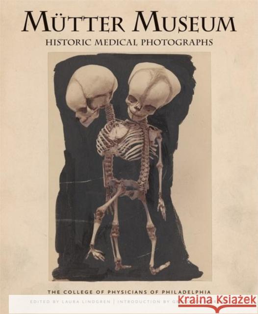 Mutter Museum Historic Medical Photographs College of Physicians of Philadelphia    Laura Lindgren Gretchen Worden 9780922233281 Blast Books