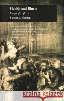 Health and Illness: Images of Difference Sander L. Gilman 9780948462696