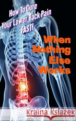 When Nothing Else Works: How To Cure Your Lower Back Pain Fast! Howe, S. F. 9780977433599 Diamond Star Press