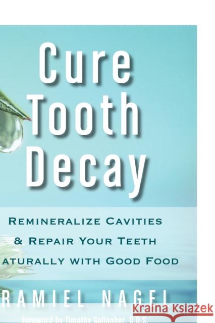 Cure Tooth Decay: Remineralize Cavities and Repair Your Teeth Naturally with Good Food Nagel, Ramiel 9780982021323 Golden Child Publishing