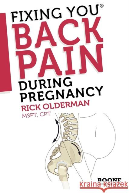 Fixing You: Back Pain During Pregnancy Olderman, Rick 9780982193747 Boone Publishing, LLC