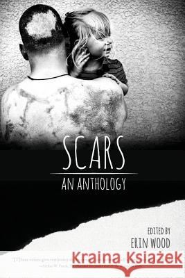 Scars: An Anthology Erin Wood 9780982818473 Et Alia Press