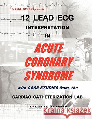 12 Lead ECG Interpretation in Acute Coronary Syndrome with Case Studies from the Cardiac Catheterization Lab Wayne W. Ruppert 9780982917213 Trigen Publishing Company