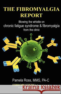 The Fibromyalgia Report: Blowing the whistle on chronic fatigue syndrome and fibromyalgia from the clinic Ross Pa-C, Pamela 9780985011024 Institute for Wellbeing