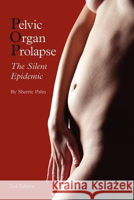 Pelvic Organ Prolapse: The Silent Epidemic Sherrie J. Palm 9780985535605 Pop Publishing & Distribution