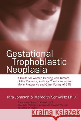 Gestational Trophoblastic Neoplasia: A Guide for Women Dealing with Tumors of the Placenta, such as Choriocarcinoma, Molar Pregnancy and Other Forms o Schwartz Ph. D., Meredith 9780985972448 Your Health Press
