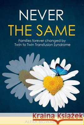 Never the Same: Families Forever Changed by Twin to Twin Transfusion Syndrome Alexa H. Bigwarfe 9780986196980