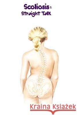 Scoliosis: Straight Talk Sealy V 9780988032743