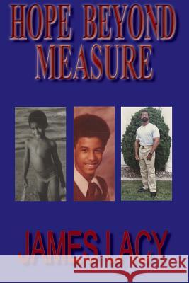 Hope Beyond Measure James Lacy 9780989874830