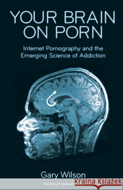 Your Brain on Porn: Internet Pornography and the Emerging Science of Addiction Gary Wilson Anthony Jack  9780993161605 Commonwealth Publishing