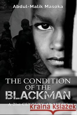 The condition of the Blackman: A 21st Century Analysis Masoka, Abdul-Malik 9780994706997