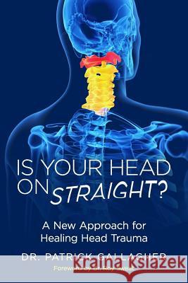 Is Your Head On Straight?: A New Approach for Healing Head Trauma Sweat, Roy 9780998935300