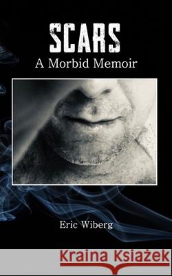 Scars: A Morbid Memoir Eric Wiberg 9780999847947