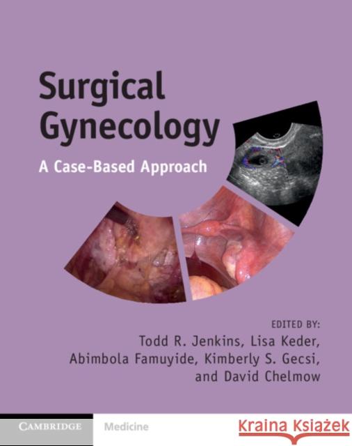 Surgical Gynecology: A Case-Based Approach Todd R. Jenkins (University of Alabama, Birmingham), Lisa Keder, Abimola Famuyide, Kimberly S. Gecsi, David Chelmow 9781009001816