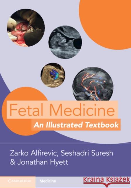 Fetal Medicine: An Illustrated Textbook Zarko Alfirevic Seshadri Suresh Jonathan Hyett 9781009015943 Cambridge University Press