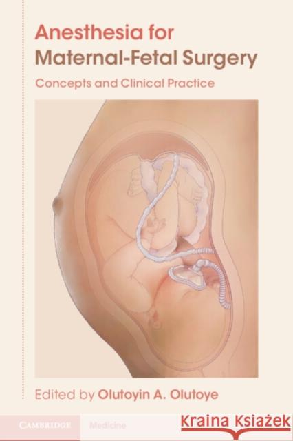 Anesthesia for Maternal-Fetal Surgery: Concepts and Clinical Practice Olutoyin A. Olutoye 9781009088909 Cambridge University Press
