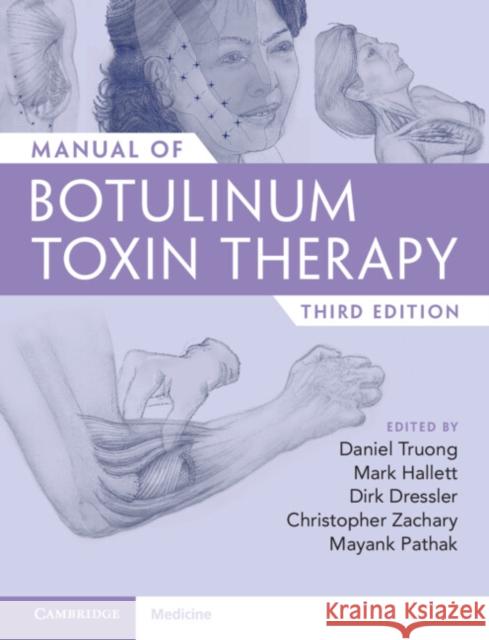 Manual of Botulinum Toxin Therapy Daniel Truong Dirk Dressler Mark Hallett 9781009098663 Cambridge University Press