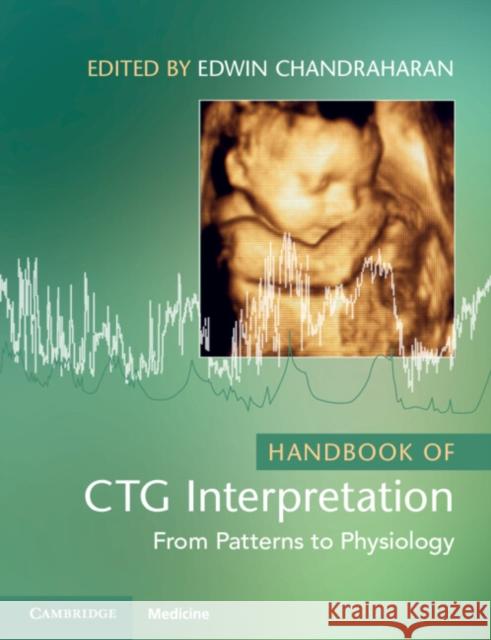 Handbook of CTG Interpretation: From Patterns to Physiology Edwin Chandraharan 9781009322300 Cambridge University Press