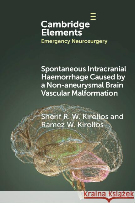 Spontaneous Intracranial Haemorrhage Caused by a Non-aneurysmal Brain Vascular Malformation Ramez W. (National Neuroscience Institute) Kirollos 9781009439374 Cambridge University Press