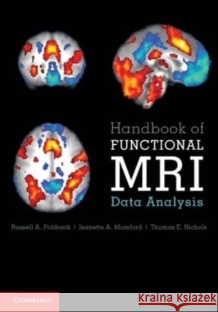 Handbook of Functional MRI Data Analysis Thomas E. (University of Warwick) Nichols 9781009481168 Cambridge University Press