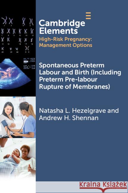 Spontaneous Preterm Labour and Birth (Including Preterm Pre-labour Rupture of Membranes) Andrew (King's College London) Shennan 9781009508919