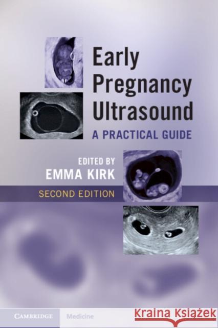 Early Pregnancy Ultrasound: A Practical Guide  9781009519021 Cambridge University Press