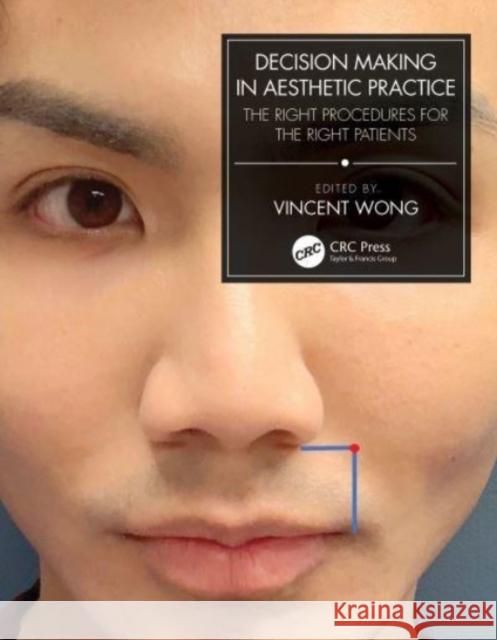 Decision Making in Aesthetic Practice: The Right Procedures for the Right Patients Vincent Wong 9781032046037